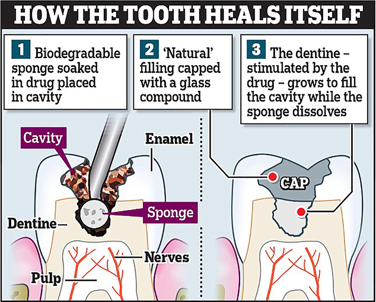 Scientists Have Discovered A Drug That Regrows Teeth And Fixes Cavities
