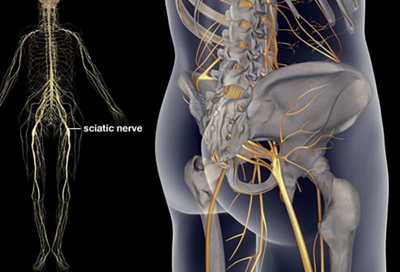 How to Relieve Sciatic Nerve Pain and Back Pain Using Only a Tennis