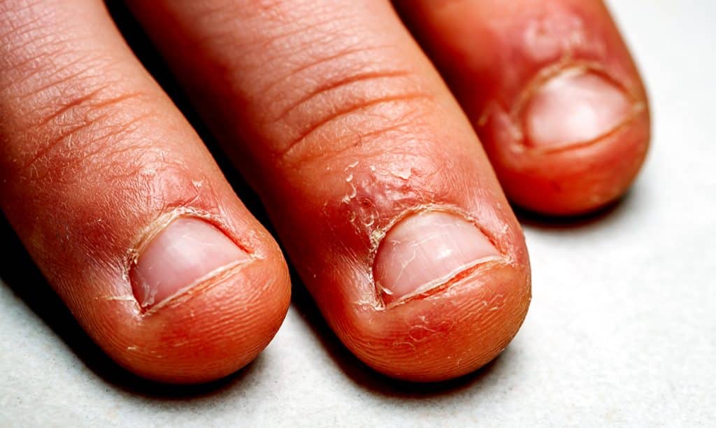 What Psychology Reveals About A Nail Biter S Personality Awareness Act