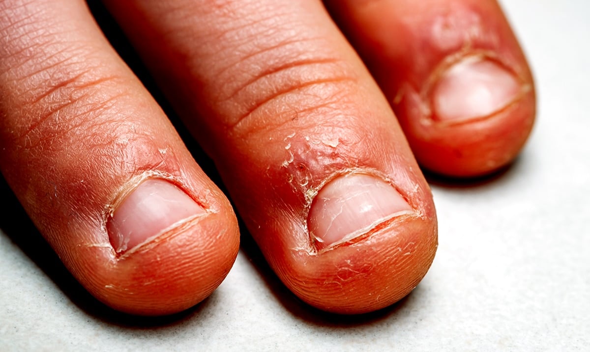 What Psychology Reveals About A Nail Biter’s Personality