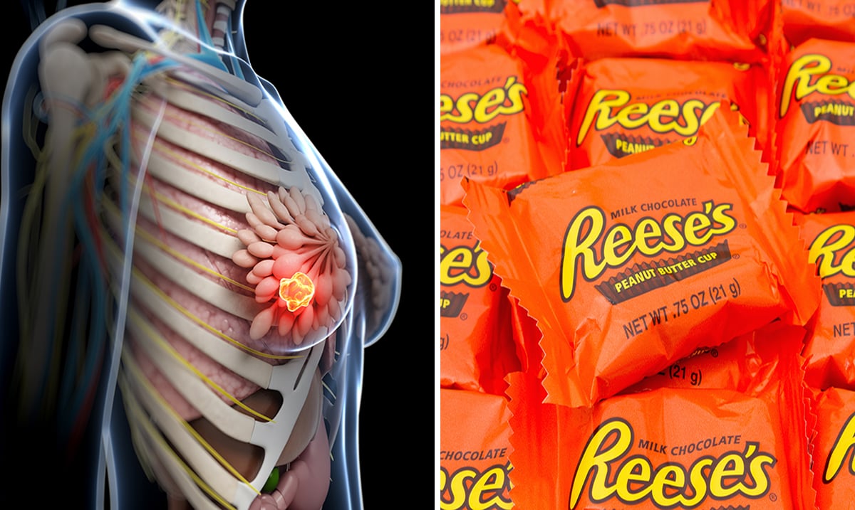5 Reasons To Never Eat A Reese’s Peanut Butter Cup Again!