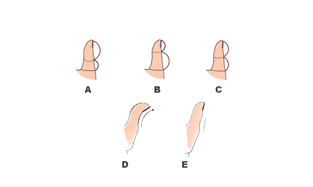 The Shape Of Your Thumb Reveals A Lot About Your Hidden Personality