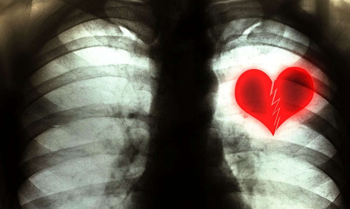 What Happens To Your Body When You Have A Broken Heart