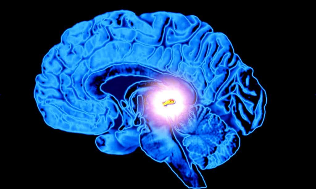 13 Ways To Decalcify Your Pineal Gland – Awareness Act