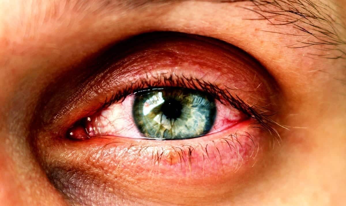 10 Things Your Eyes Can Reveal About Your Health