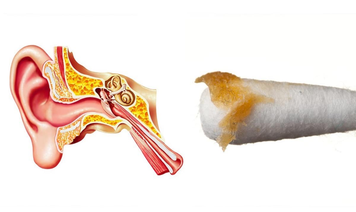 7 Reasons You Need To Stop Using Cotton Buds To Clean Your Ears