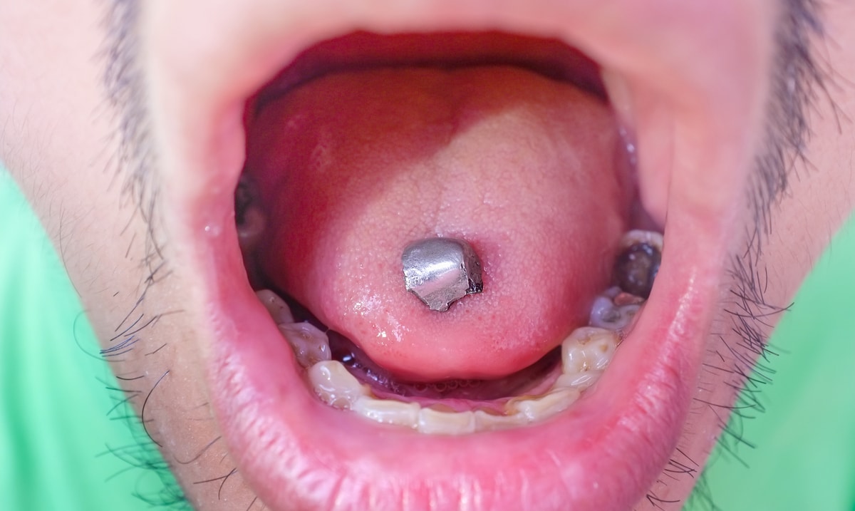 6 Diseases That Have Been Linked To Mercury Fillings