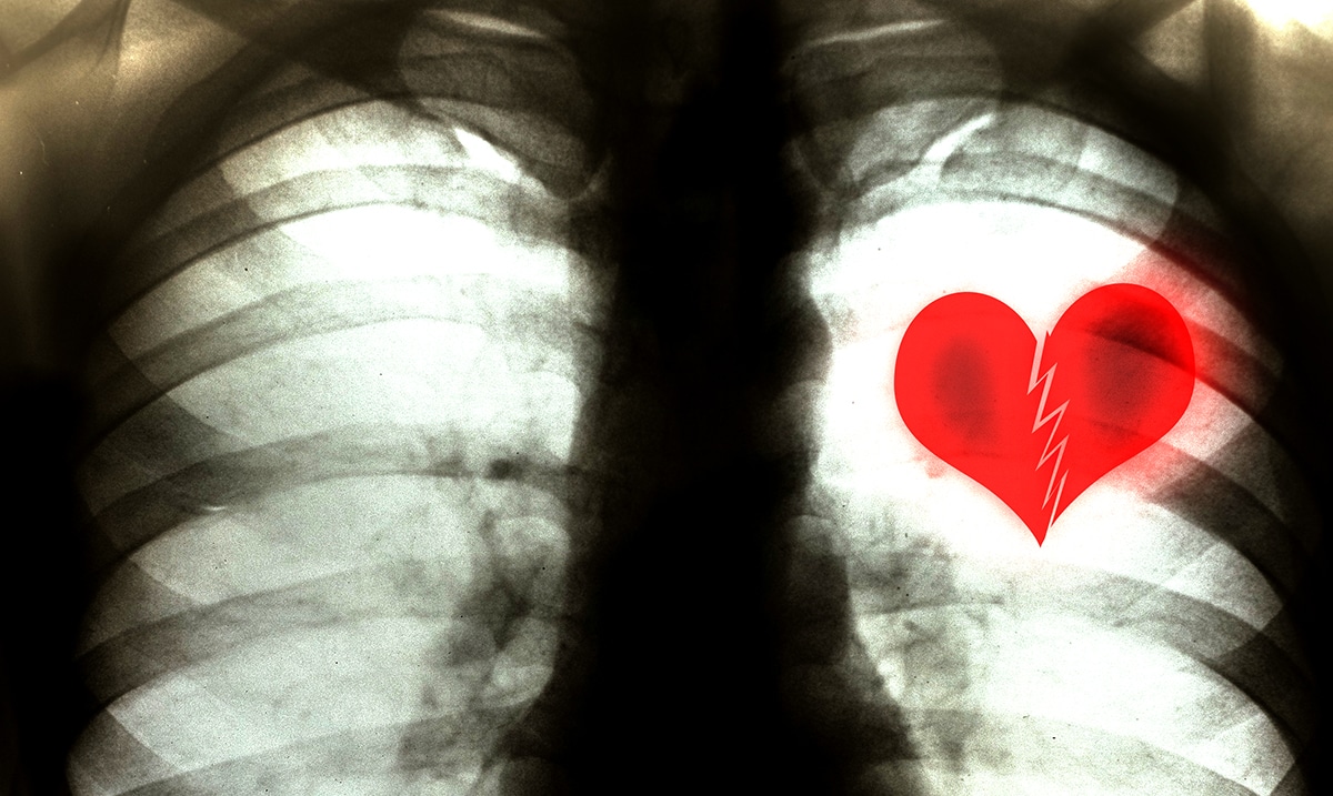 You Can Actually Die From A Broken Heart – Cardiologist Explains
