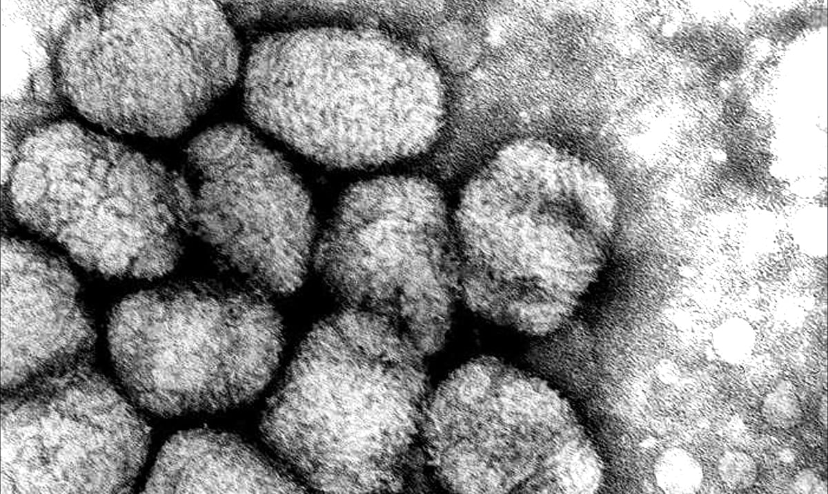 Only Two Labs In The World Have Samples Of Smallpox And Part Of One Literally Just Exploded