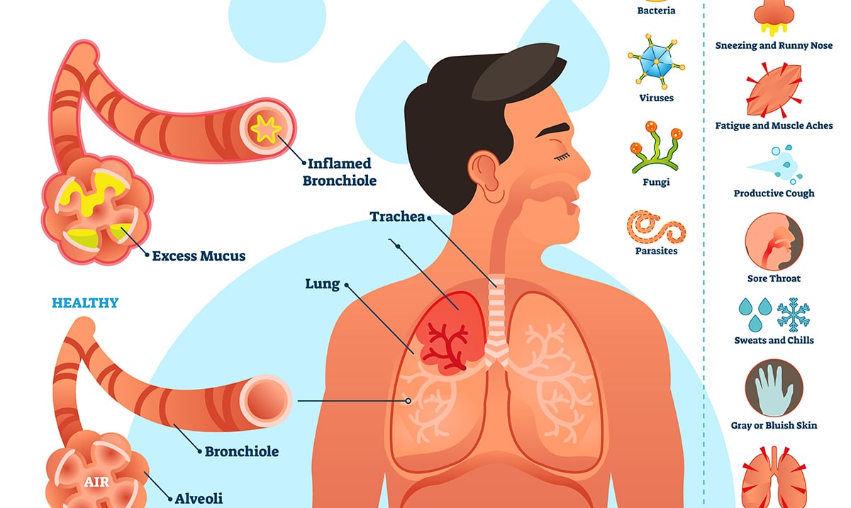 Ways To Eliminate Mucus And Phlegm From The Throat And Chest 