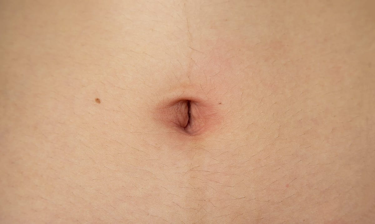 ‘Belly Button Therapy’: Putting Oils In Your Belly Button Benefit Your Health?