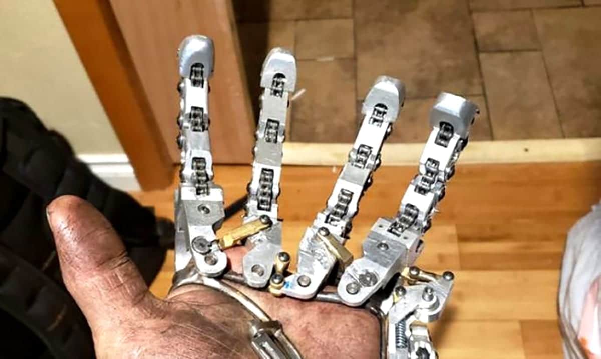 They Denied Him A Prosthetic Hand So He Built His Own