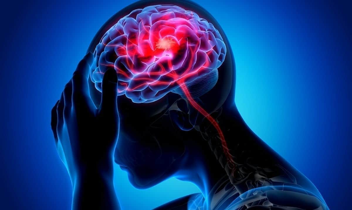 Study Suggests COVID-19 Survivors Could Be At Risk Of Stroke And Brain Disorders
