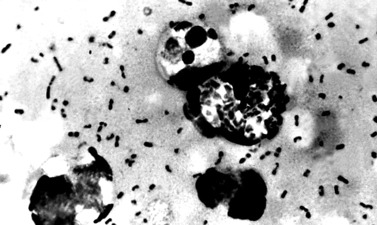 Possible Case Of Bubonic Plague Diagnosed In China