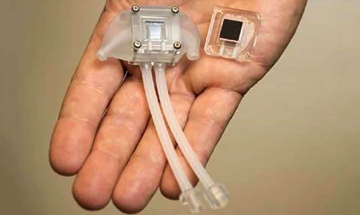 Artificial Kidney Could Eliminate The Need For Kidney Dialysis