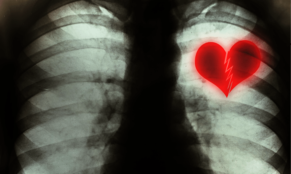 12 Surprising Things That Happen To Your Body When You Are Heartbroken