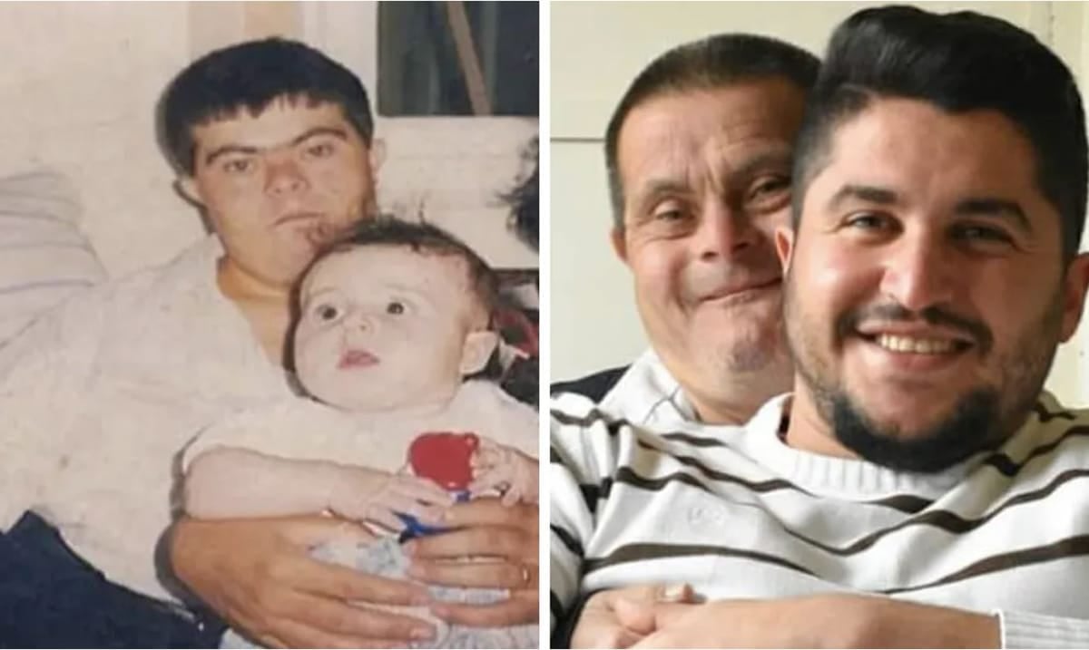 Man Raised By Father With Down Syndrome Has Powerful Message to Share