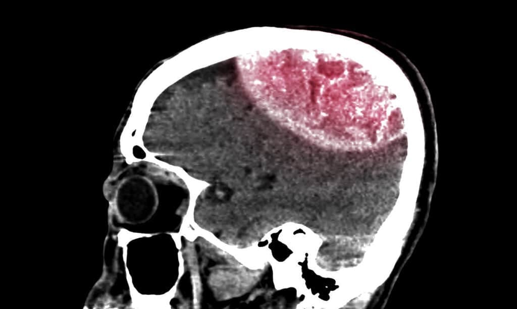 When You Die You Know You Are Dead, According to Scientists – Awareness Act