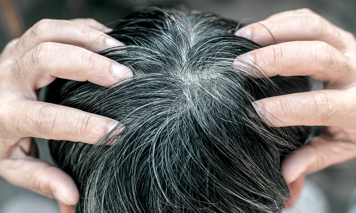 New Research Explains The Scientific Link Between Stress And Gray Hair