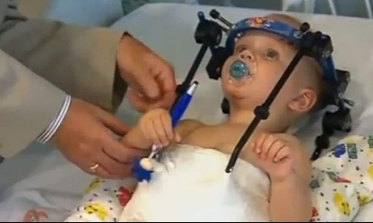 Toddler’s Head Reattached After Internal Decapitation