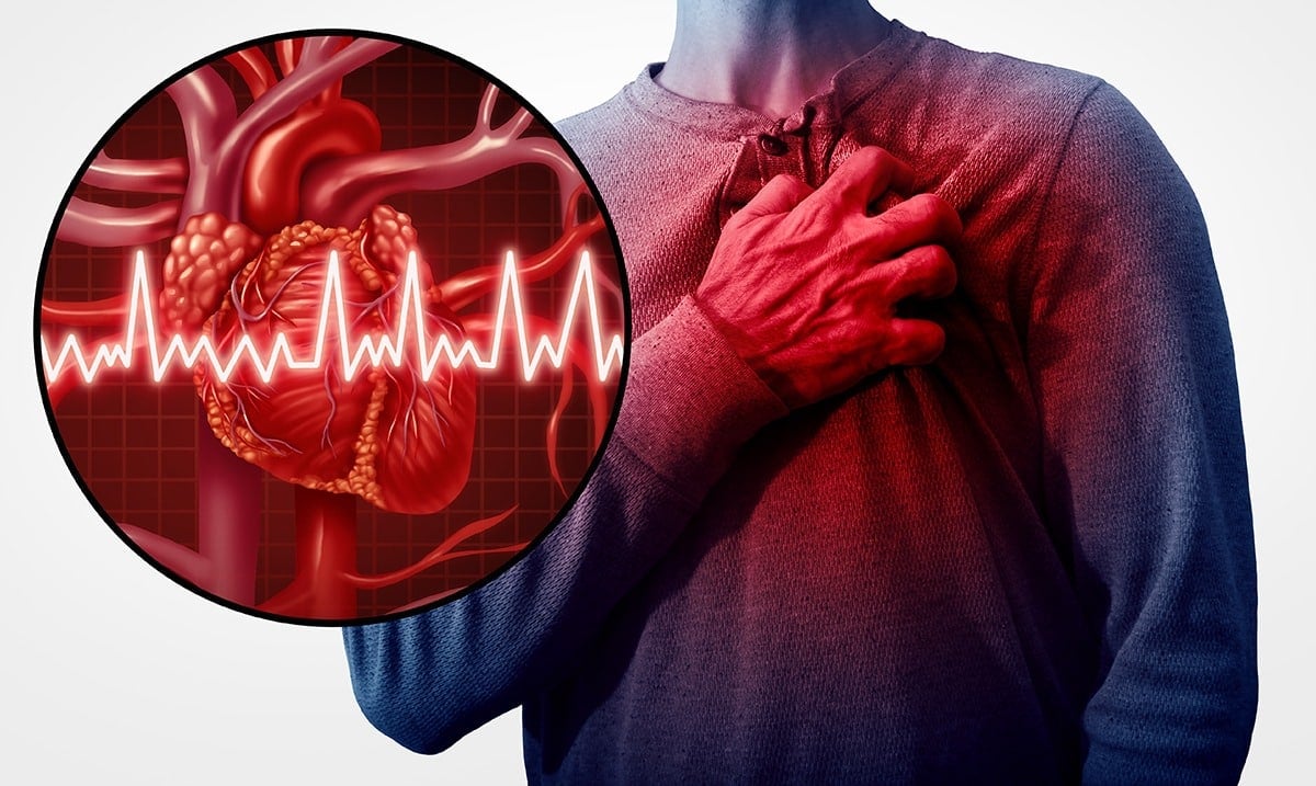 10 Signs You Are Living With Clogged Arteries