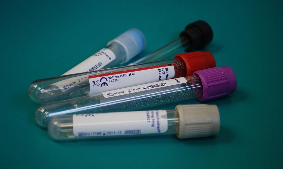 New STI: Doctors Warn It May Already Affect Millions
