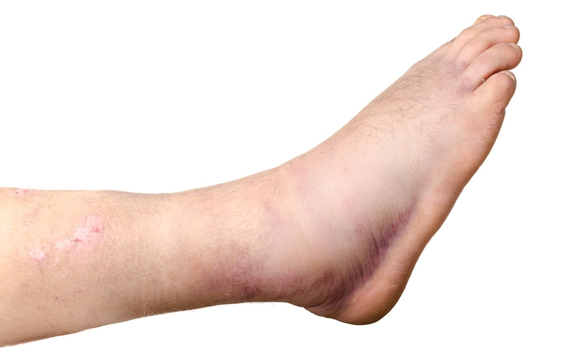 11 Strange Signs Of Heart Disease You Need To Know