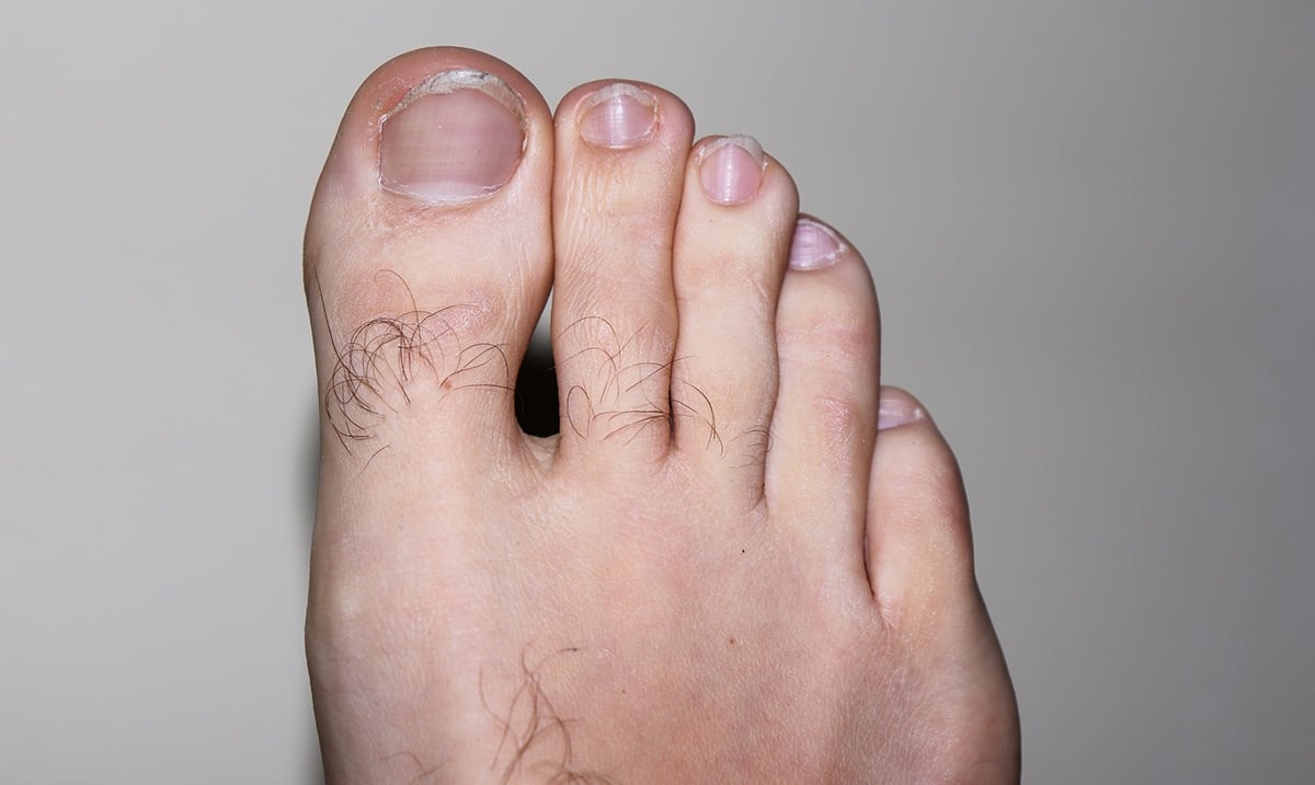 Health Expert Reveals Warning Signs of Two Silent Foot Killers — And How to Spot Them Early