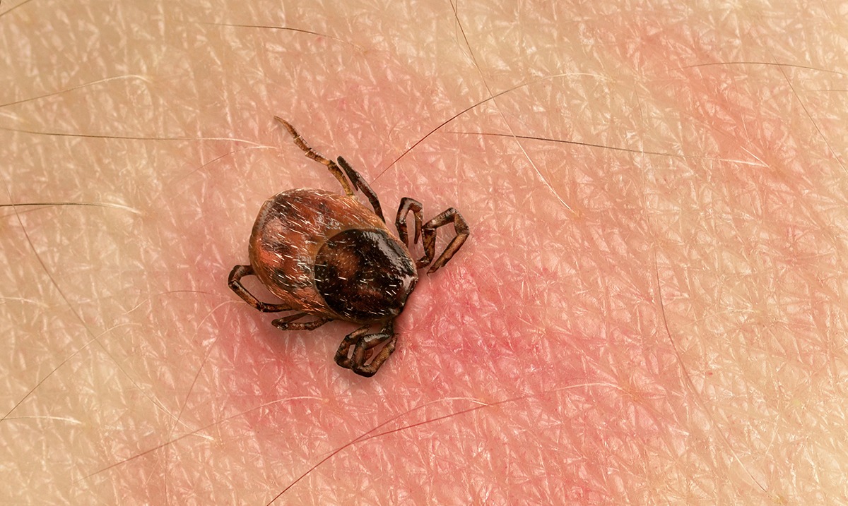 Why You Should Never Flush A Tick Down The Toilet