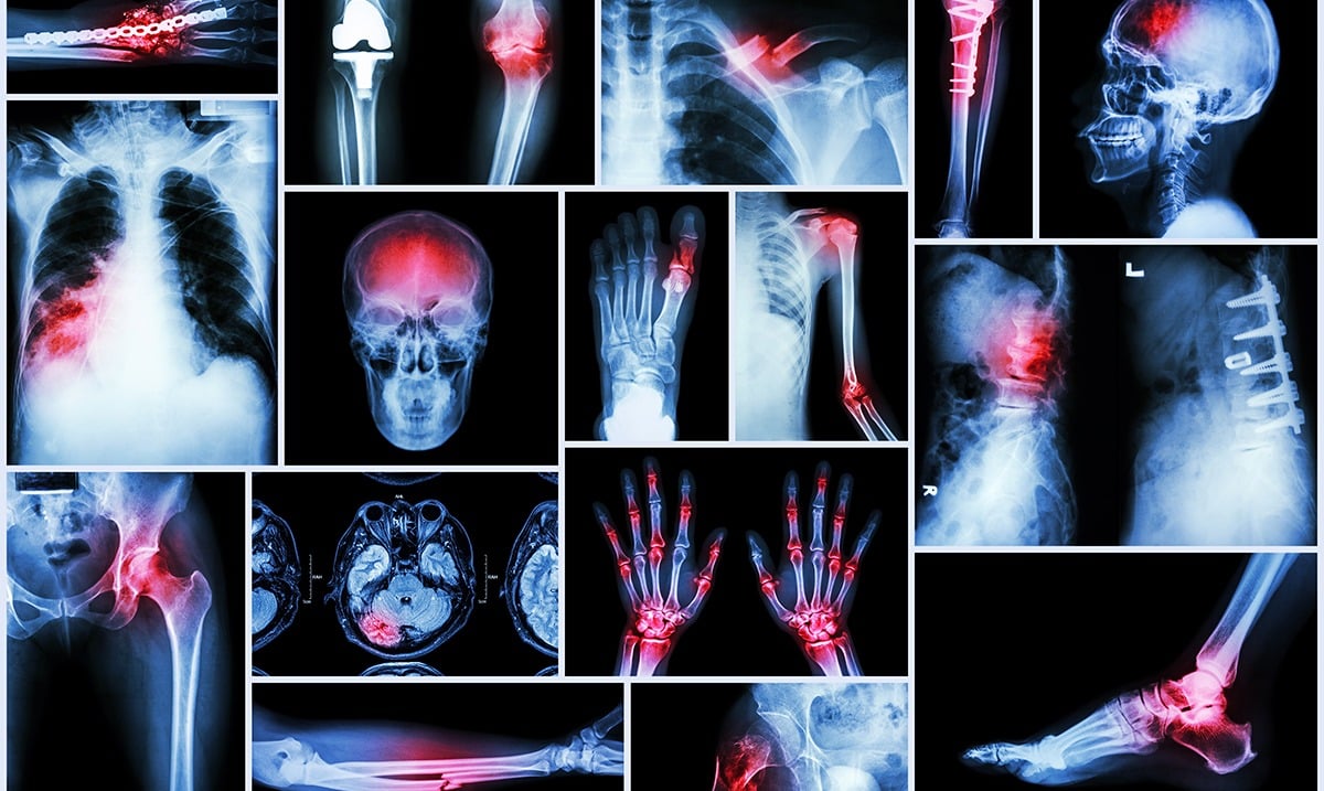 If Your Kidneys Are in Danger, Your Body Will Give You These 10 Signs